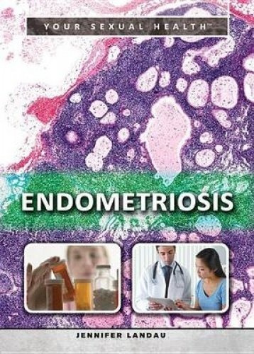 Endometriosis (your Sexual Health)