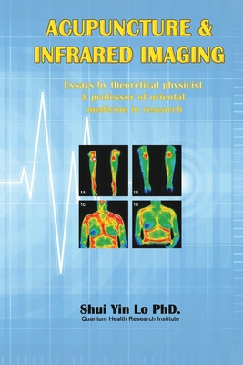 Libro Acupuncture And Infrared Imaging: Essays By Theoret...