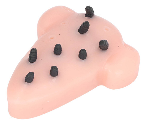 Brinquedo Para Remover Cravos, Espinhas, Apertar O Nariz, Em