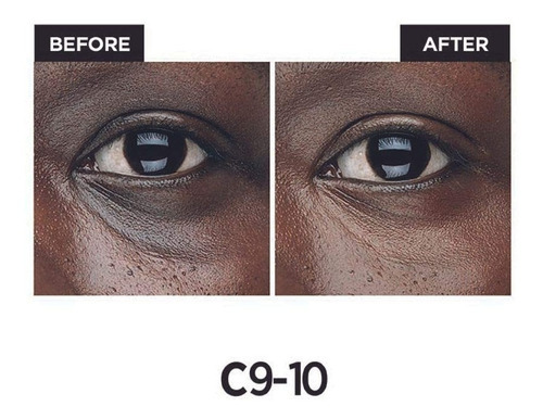 Creme Loreal True Match Para Os Olhos Em Um Corretivo Tom Deep C9-10