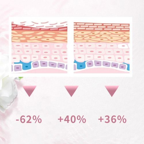 Parche Adhesivo Para Dar Forma A Las Nalgas, Promover La