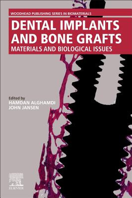 Libro Dental Implants And Bone Grafts: Materials And Biol...