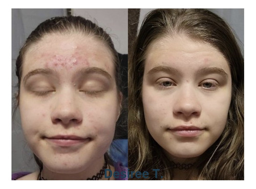 Neora Limpiador Desmaquillante De Rostro Botanico Vegano