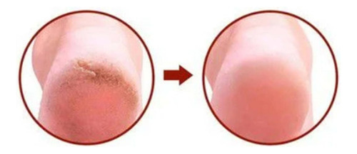 Creme Rachaduras Pes Ureia Hidratante Intenso Regenerador
