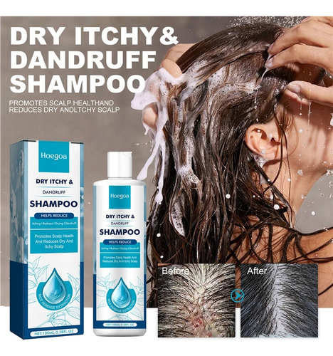 Mp ChampĂș Refrescante Anticaspa 100 Ml 1 Unidad