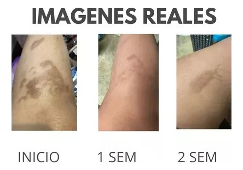 Crema Blanqueadora Aclaradora Partes Intimas, Ojeras Manchas