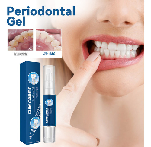 O Gel Blanqueador Dental Para Reducir Las Manchas Amarillas