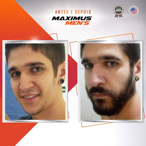 Imagem 8 de 10 de Maximus Beard Para Crescimento De Barba - Tratamento 30 Dias