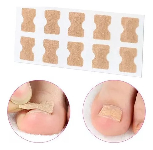 50 Parches Correctores Uñas Enterradas Uñeros Adhesivos