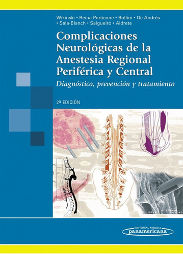 Complicaciones Neurológicas De La Anestesia Regional Perif, De Wikinski. Editorial Medica Panamericana, Tapa Blanda, Edición 2 En Español, 2011