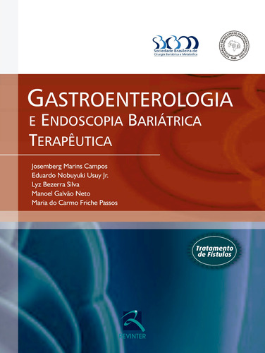 Gastroenterologia e Endoscopia Bariátrica Terapêutica, de Campos, Josemberg Marins. Editora Thieme Revinter Publicações Ltda, capa dura em português, 2016