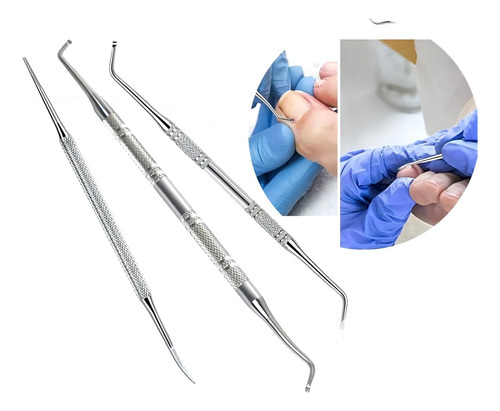 3pcs Herramienta Para Uñas Encarnadas Lima Para Uñas Del Pie