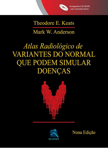 Atlas Radiológico De Variantes Do Normal Que Podem Simular 