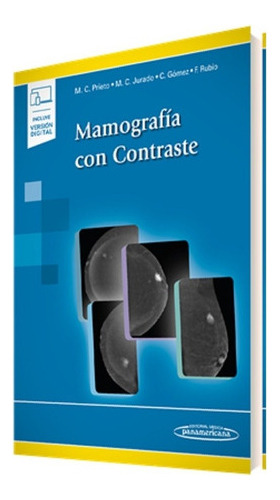 Mamografia Con Contraste Duo Prietoeds