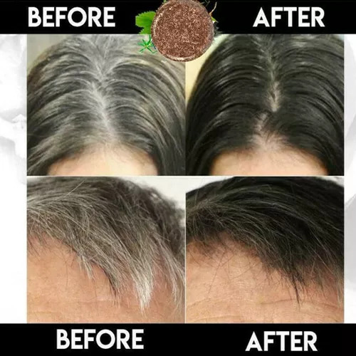 Shampoo Barra De Escurecimento New Polygonum Essence Hair