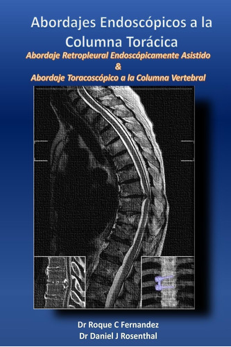 Libro Abordajes Endoscopicos A Columna Toracica Español