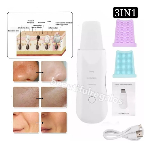 Espátula Facial Ultrasónica Peeling Skin Scrubber Recargable
