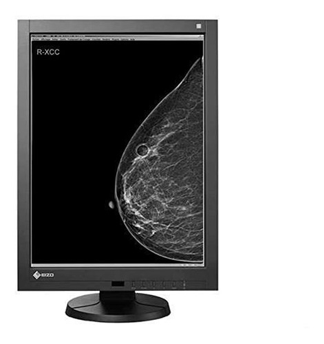 Renovado® Eizo Radiforce Gx540 5mp Monochrome Digital Mammog