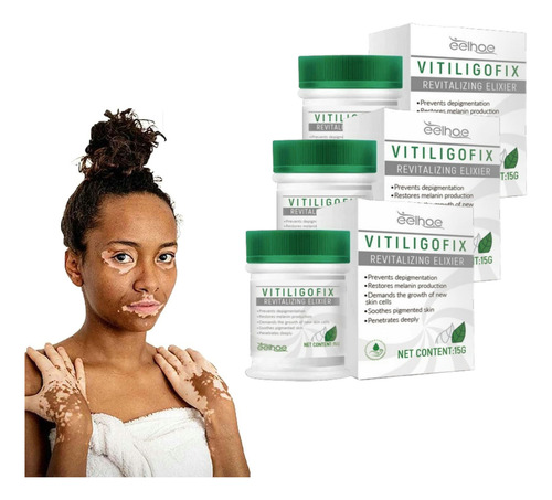 3 × Pomada Blanca Para El Vitíligo, Crema Para La Micosis, L