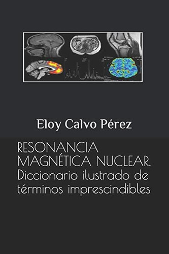 Resonancia Magnetica Nuclear : Diccionario Ilustrado De Terminos Imprescindibles, De Eloy Calvo Perez. Editorial Independently Published, Tapa Blanda En Español