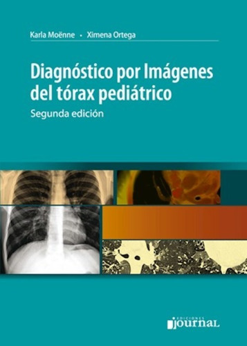 Diagnóstico Por Imágenes Del Tórax Pediátrico Moenne Envíos