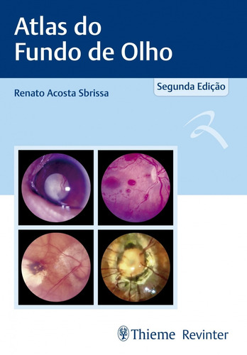 Atlas do Fundo de Olho, de Sbrissa, Renato Acosta. Editora Thieme Revinter Publicações Ltda, capa mole em português, 2018