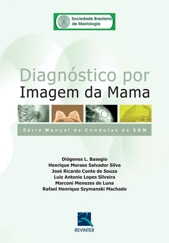 Diagnóstico por Imagem da Mama: Série Manual de Condutas da SBM, de Basegio, Diógenes L.. Editora Thieme Revinter Publicações Ltda, capa mole em português, 2007