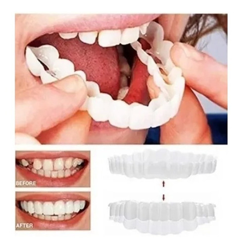 Silicone Upper/lower Smile False Teeth Veneers W