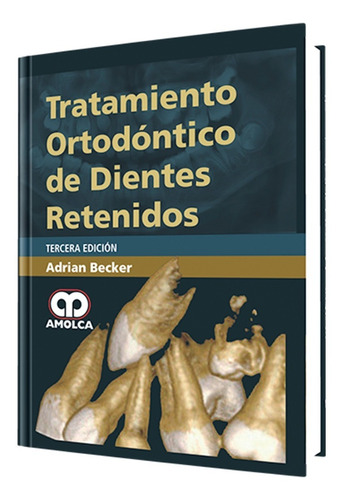 Tratamiento Ortodóntico De Dientes Retenidos. 3ª Edición.