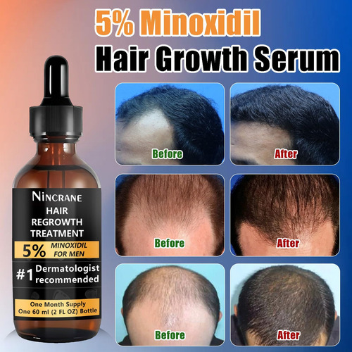 Kit Para El Crecimiento Del Cabello Y La Barba Nincrane 5% M