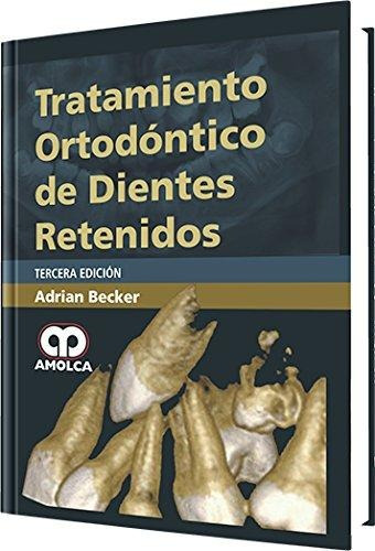 Tratamiento Ortodóntico De Dientes Retenidos 3ª Ed Amolca