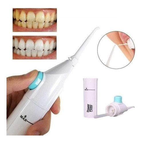 Irrigador Bucal Para Limpieza Dental Brakets Presión C/ Agua