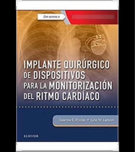 Implantes Quirúrgicos De Dispositivos