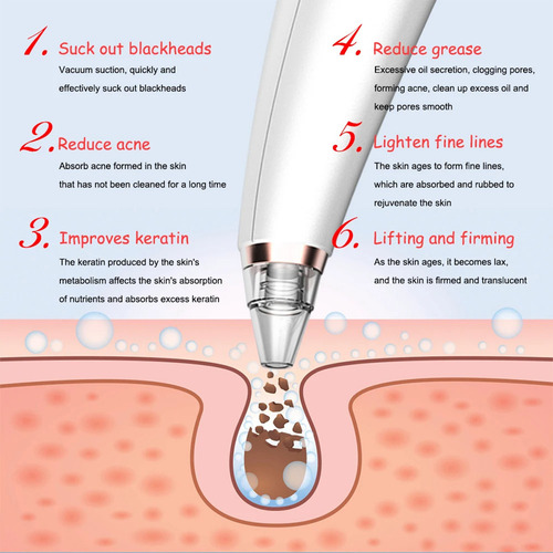 Aspiradora G Blackhead Extractor Pore Vac 4001