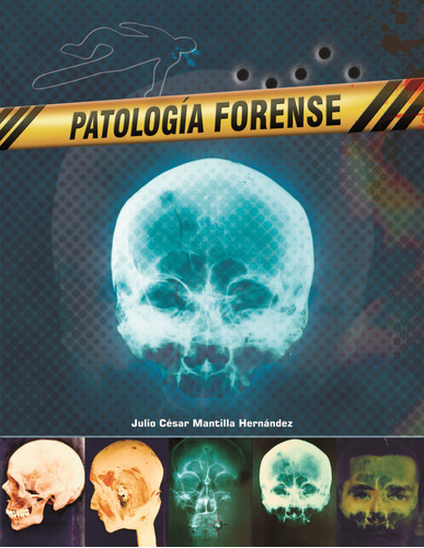 Patología Forense, De Julio César Mantilla Hernández. Editorial U. Industrial De Santander, Tapa Blanda, Edición 2008 En Español