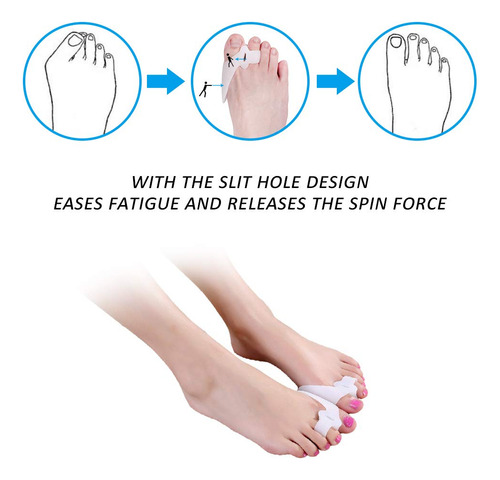 Separador De Dedos De Gel Para Juanetes, Corrector De Dedos