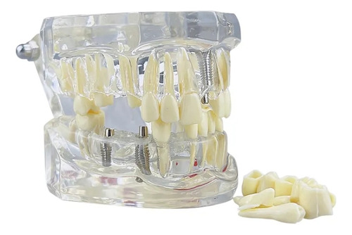 Modelo Dental Didáctico De Estudio Y Demostracion