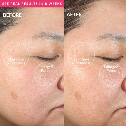 Pmd Clean Dispositivo De Limpieza Facial Inteligente Con