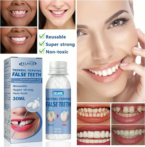 Gránulos moldeables de reparación dental de dientes postizos, kit de  reparación de dientes, perlas de reparación dental temporal de bricolaje