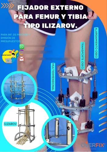 Fijador Externo De Ilizarov