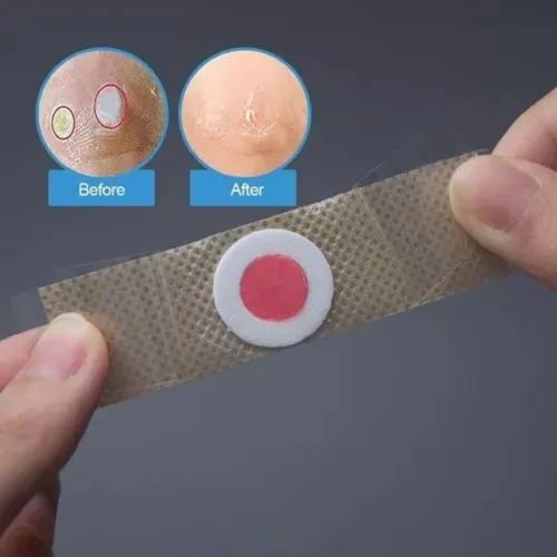 Pegatina Para Eliminar Verrugas, Callos, Ojo De Pescado