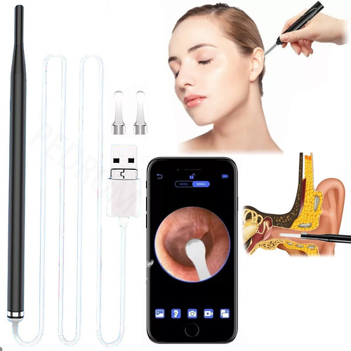 Limpiador Oídos Inteligente Con Luces Y Cámara Y Endoscopio