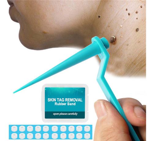 - Kit De Eliminación De Etiquetas N Skin Para Verrugas Y