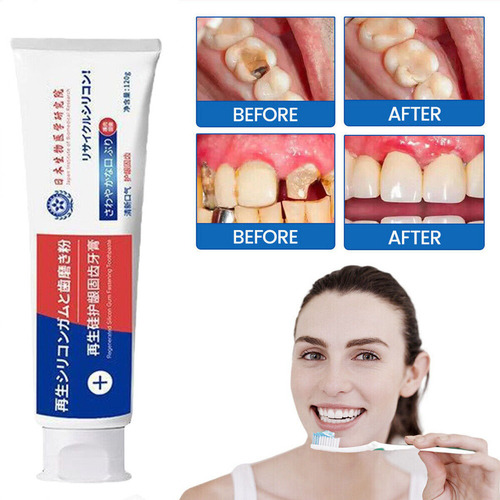 V Reparación Rápida De Caries Pasta De Dientes Para Caries