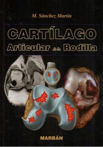 Cartílago Articular De La Rodilla Sánchez Martín, De M. Sánchez Martín., Vol. 1. Editorial Marban, Tapa Dura, Edición 1 En Español, 2011