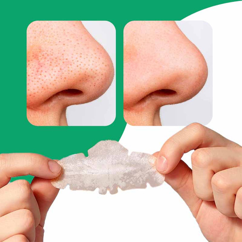 Pack De 10 Parches Anti-acne Para Nariz Luminex