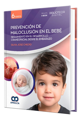 Prevención De Maloclusión En El Bebé. Incluye E-book  Videos
