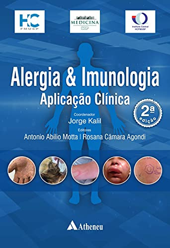 Libro Alergia E Imunologia  Aplicacao Clinica