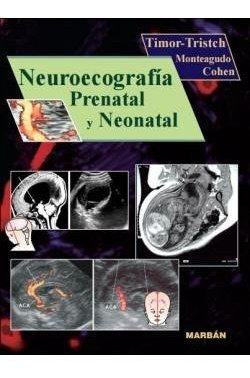 Neuroecografia Prenatal Y Neonatal - Timor-tritsch, I. E....