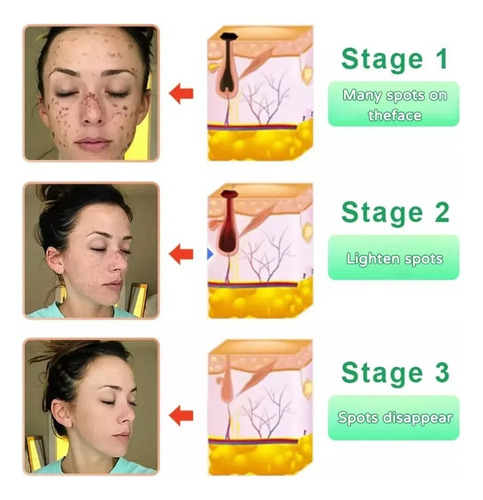 Quarxeri Purificante Exfoliante, Gel Exfoliante Avanzado 2 P